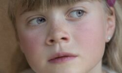 Отравление Нафтизином: признаки и первая помощь