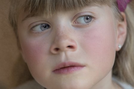 Отравление Нафтизином: признаки и первая помощь