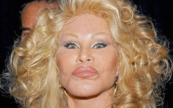 Звезды, потратившие целое состояние на пластику Звезды, потратившие целое состояние на пластику